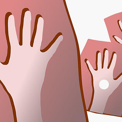 Das Loch in der Hand